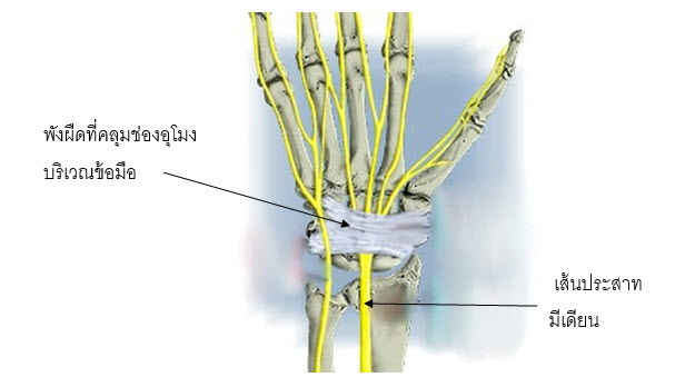Numbness | Bangkok International Hospital (Brain x Bone)