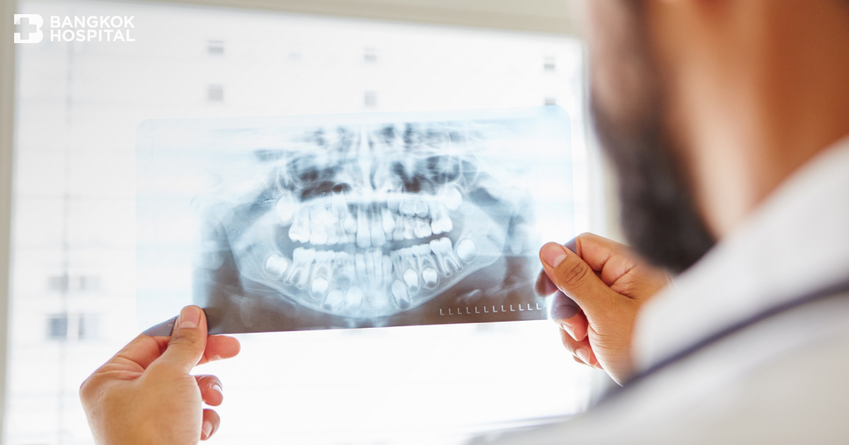 5 เรื่องที่คุณอาจไม่เคยรู้เกี่ยวกับ Maxillofacial Surgery