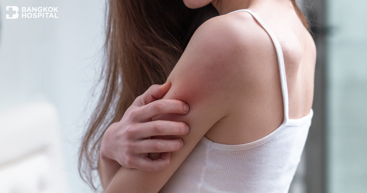 Scratching leads to more itching or it could be skin allergy.