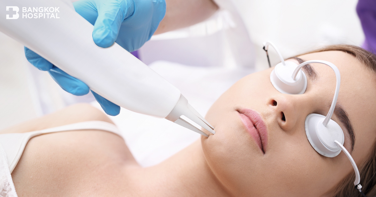 Laser technology in skin treatment