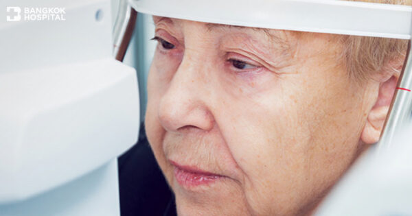 Behandlung von Glaukom Image