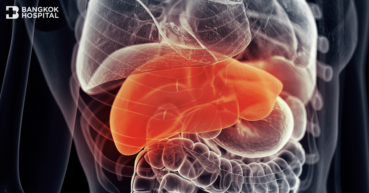 Fatty liver risk from hidden obesity