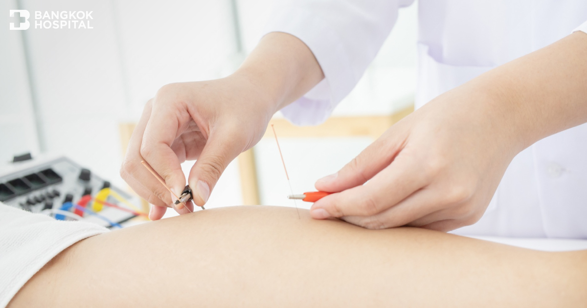 Acupuncture for Treating Injuries in Athletes