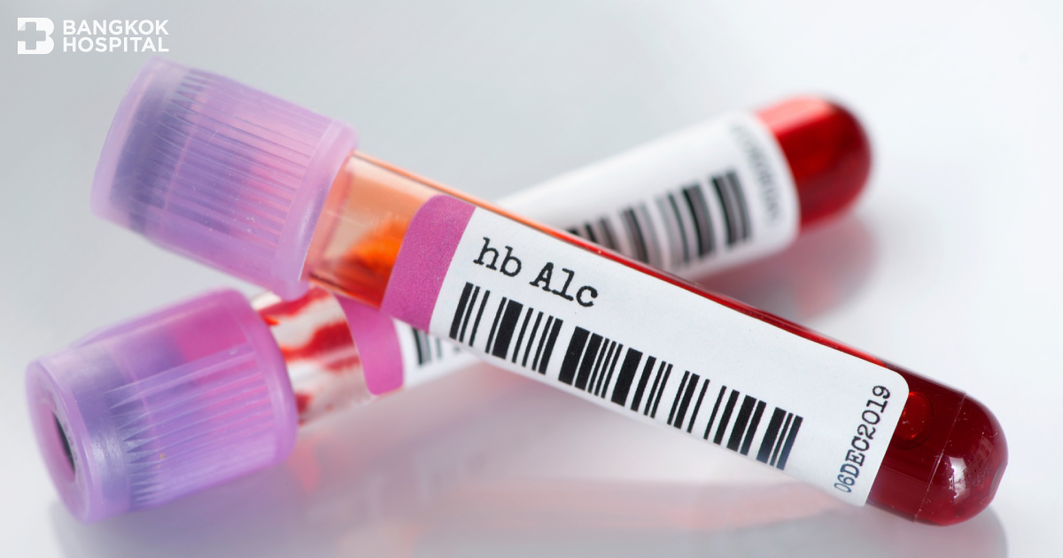 Chúng ta hãy biết hemoglobin a1c