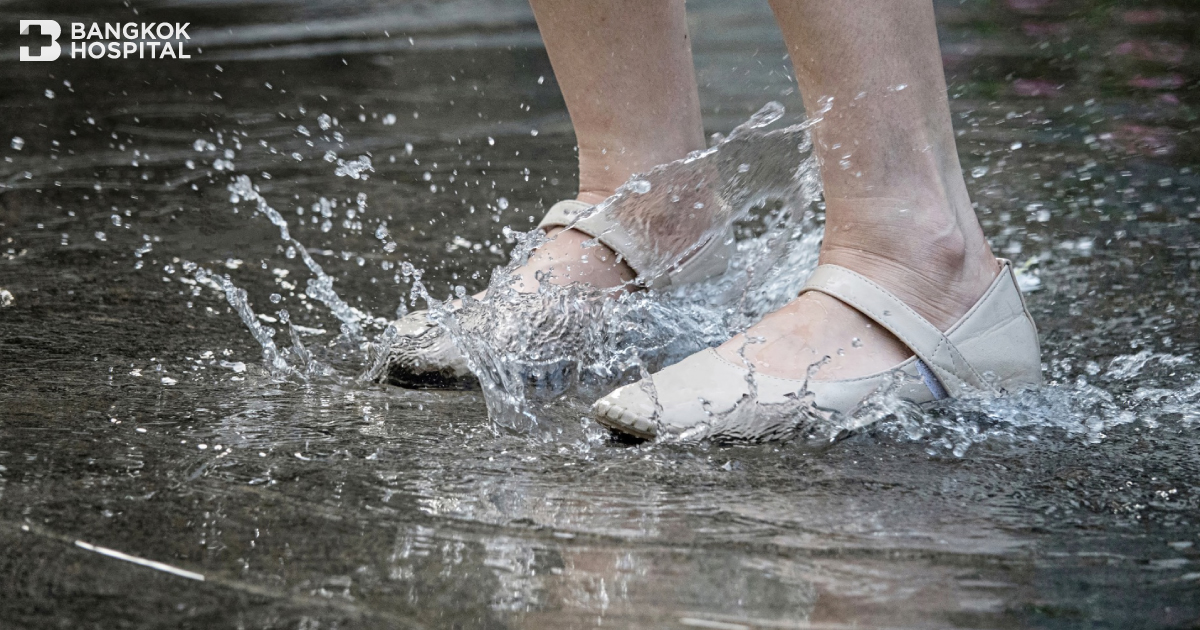 Patients with diabetes must be cautious of foot infections during the rainy season.