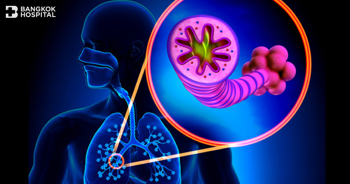 Chronic Obstructive Pulmonary Disease (COPD)