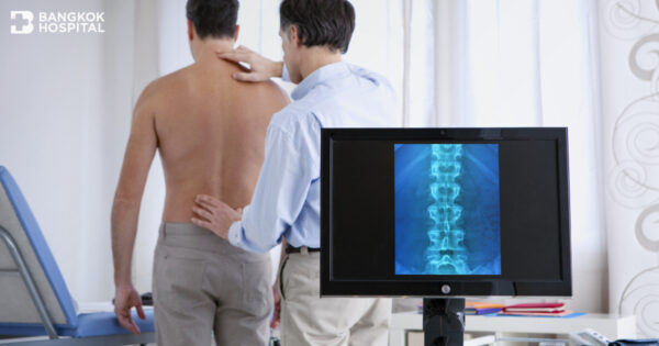 Fragen und Antworten vor der Wirbelsäulenoperation Image