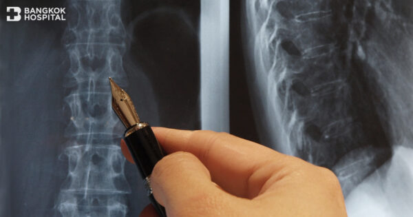 ผ่าตัดกระดูกสันหลัง MIS SPINE แผลเล็ก ฟื้นตัวเร็ว