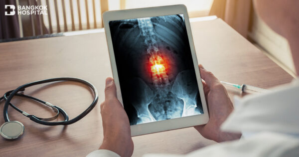 รู้ก่อนสายเนื้องอกในกระดูกสันหลังและไขสันหลัง