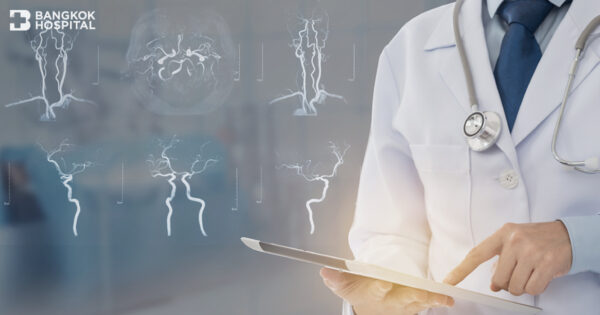 يتم علاج انسداد الشريان الدماغي بسرعة ولا يسبب الشلل. Image