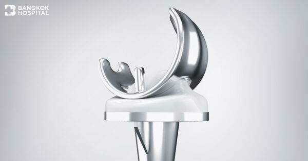 เทคโนโลยีการผ่าตัดข้อเทียม