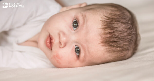 Little Hearts Need to be Cautious of COVID-19 and Kawasaki Disease Image