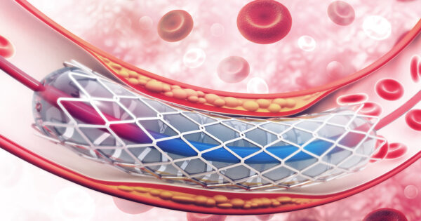 Cardiac Intervention Clinic