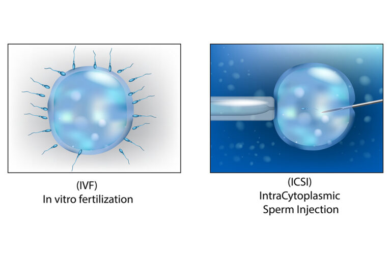 IVF & ICSI មិនថាវាលំបាកយ៉ាងណាទេ អ្នកនៅតែអាចមានកូនបាន។