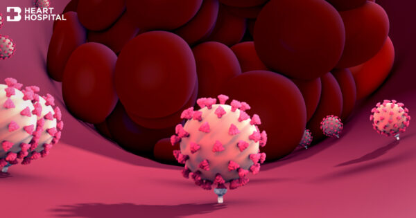 ลิ่มเลือดอุดตัน ผลข้างเคียงวัคซีนโควิด-19 จริงหรือ? Image