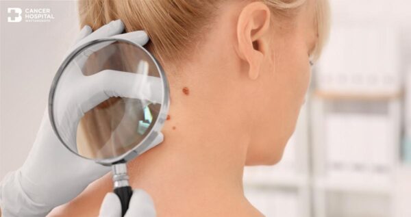 Skin Cancer Image