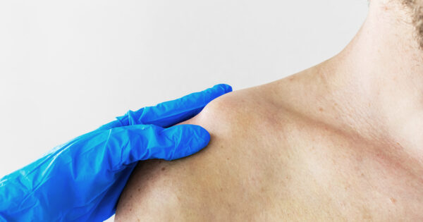 ปฐมพยาบาลกระดูกหักและข้อเคลื่อน Image