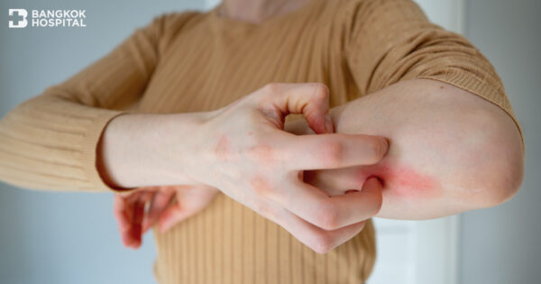 မျောက်ကျောက်အကြောင်း အမေးအဖြေ။ အထိတ်တလန့်မဖြစ်စေရန် သတိထားပါ။ Image