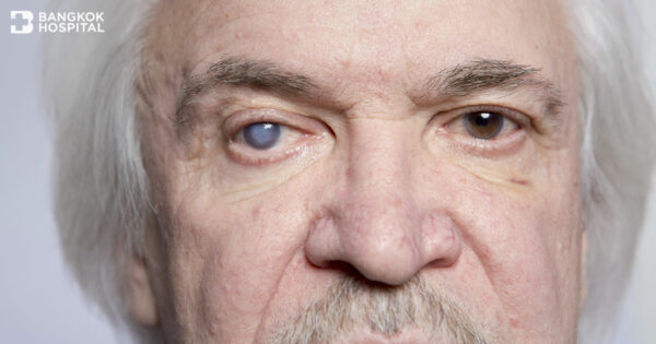 ต้อกระจกอย่านิ่งนอนใจ รีบรักษาก่อนต้อสุก Image