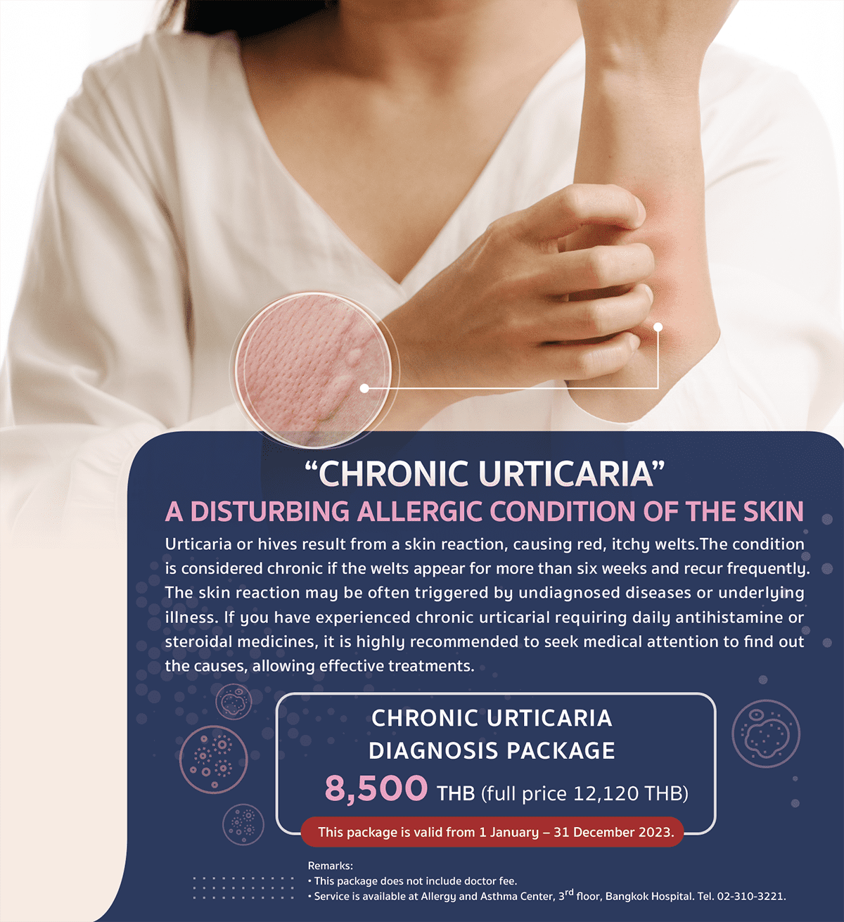 Chronic Urticaria diagnosis package Image