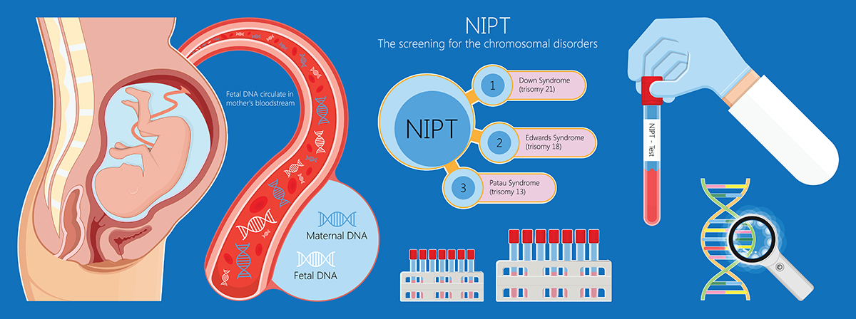 NON - INVASIVE PRENATAL TESTING (NIPT) ตรวจคัดกรองความผิดปกติของโครโมโซมทารกในครรภ์