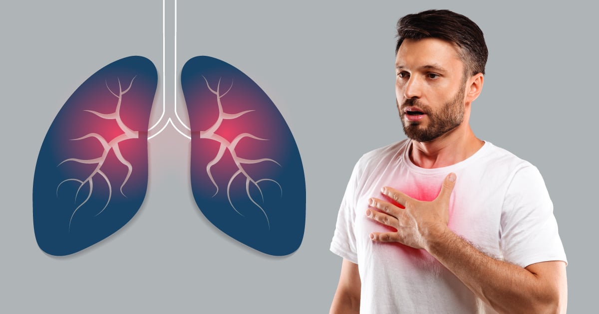 Low-dose Chest CT Scan Package Image