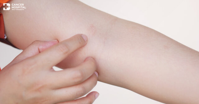 มะเร็งเนื้อเยื่ออ่อน Image