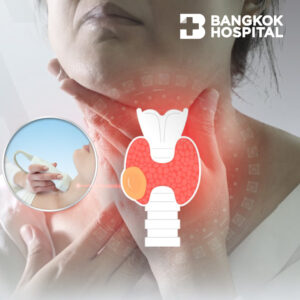 Campaign แพ็กเกจจี้เนื้องอกไทรอยด์ด้วยคลื่นความถี่สูง ไร้มีด ไร้แผลผ่าตัด Image