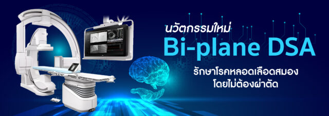 นวัตกรรมใหม่ ‘Bi-Plane DSA’ Image