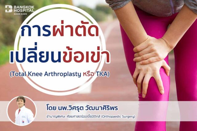 การผ่าตัดเปลี่ยนข้อเข่า (Total Knee Arthroplasty หรือ TKA) Image