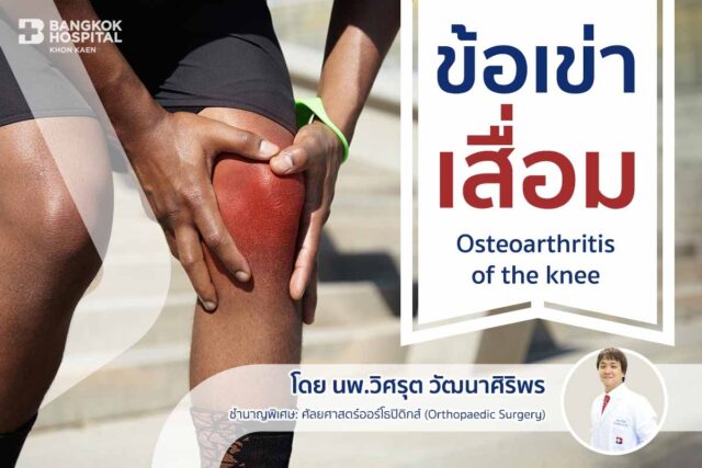 ข้อเข่าเสื่อม (Osteoarthritis of the knee) Image