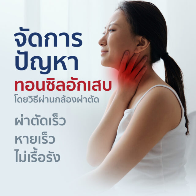 จัดการปัญหา ทอนซิลอักเสบ โดยวิธีผ่านกล้องผ่าตัด
