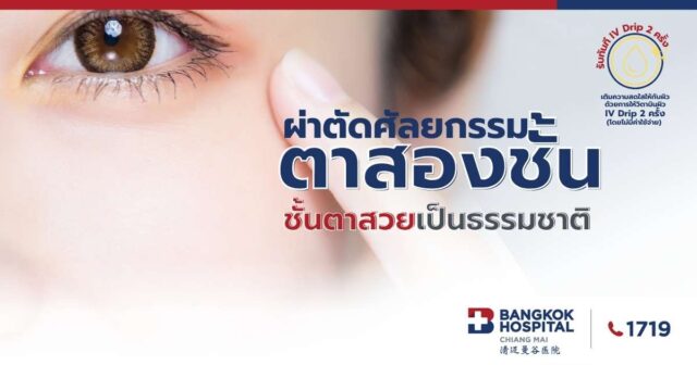 แพ็กเกจศัลยกรรมตาสองชั้น ชั้นตาสวยเป็นธรรมชาติ