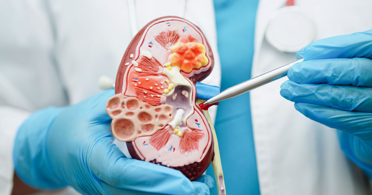 ความดัน เบาหวาน ตัวการโรคไตเรื้อรัง