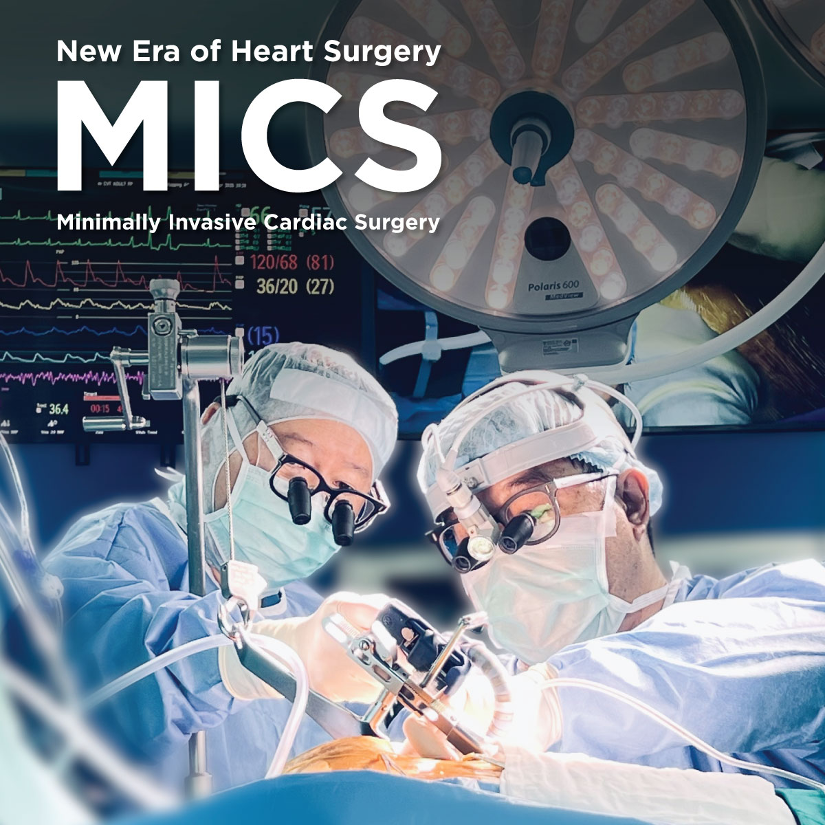 နှလုံးသွေးကြောဓာတ်မှန်ရိုက်စစ်ဆေးခြင်း/ နှလုံးသွေးကြောချဲ့ကုသခြင်းနှင့် နှလုံးသွေးကြောခွဲစိတ်ကုသခြင်း