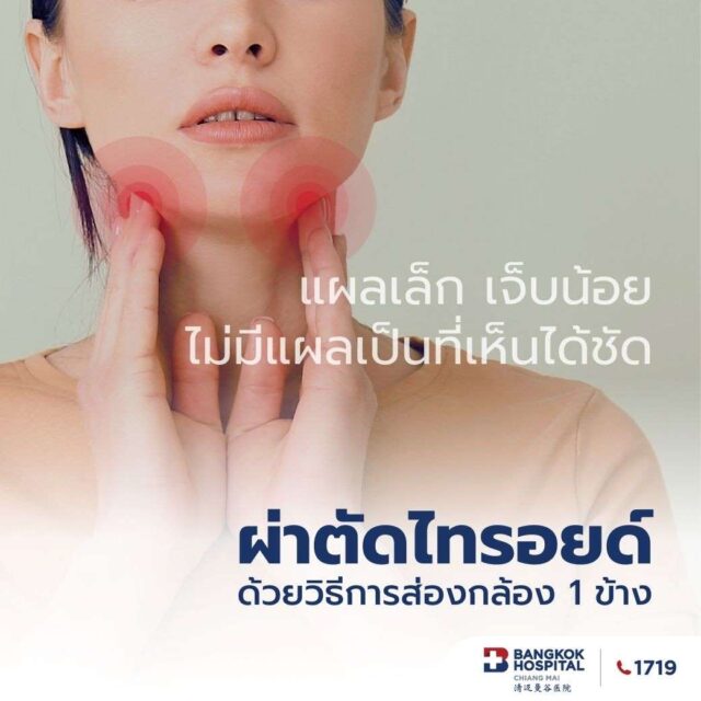 ผ่าตัดไทรอยด์ด้วยวิธีการส่งกล้อง 1 ข้าง (ผ่านช่องปาก หรือ ผ่านรักแร้) 2 คืน