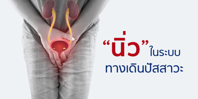 นิ่วในระบบทางเดินปัสสาวะ