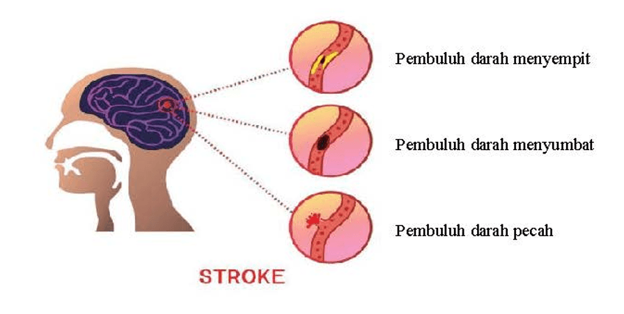 Jinsiy aloqa er xotin erkak