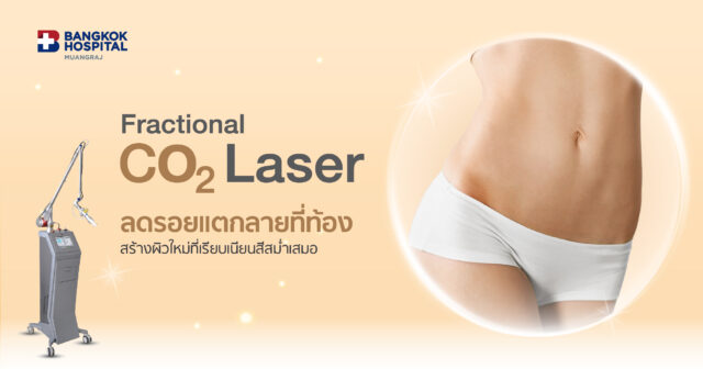 แพ็กเกจเลเซอร์รอยแตกลายที่ท้อง