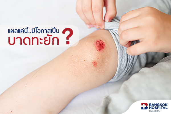 แผลแค่นี้..มีโอกาสเป็นบาดทะยัก?
