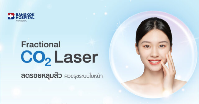 แพ็กเกจเลเซอร์หลุมสิว