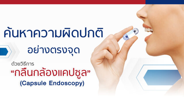 การกลืนกล้องแคปซูลเพื่อตรวจลำไส้เล็ก (Capsule Endoscopy) Image