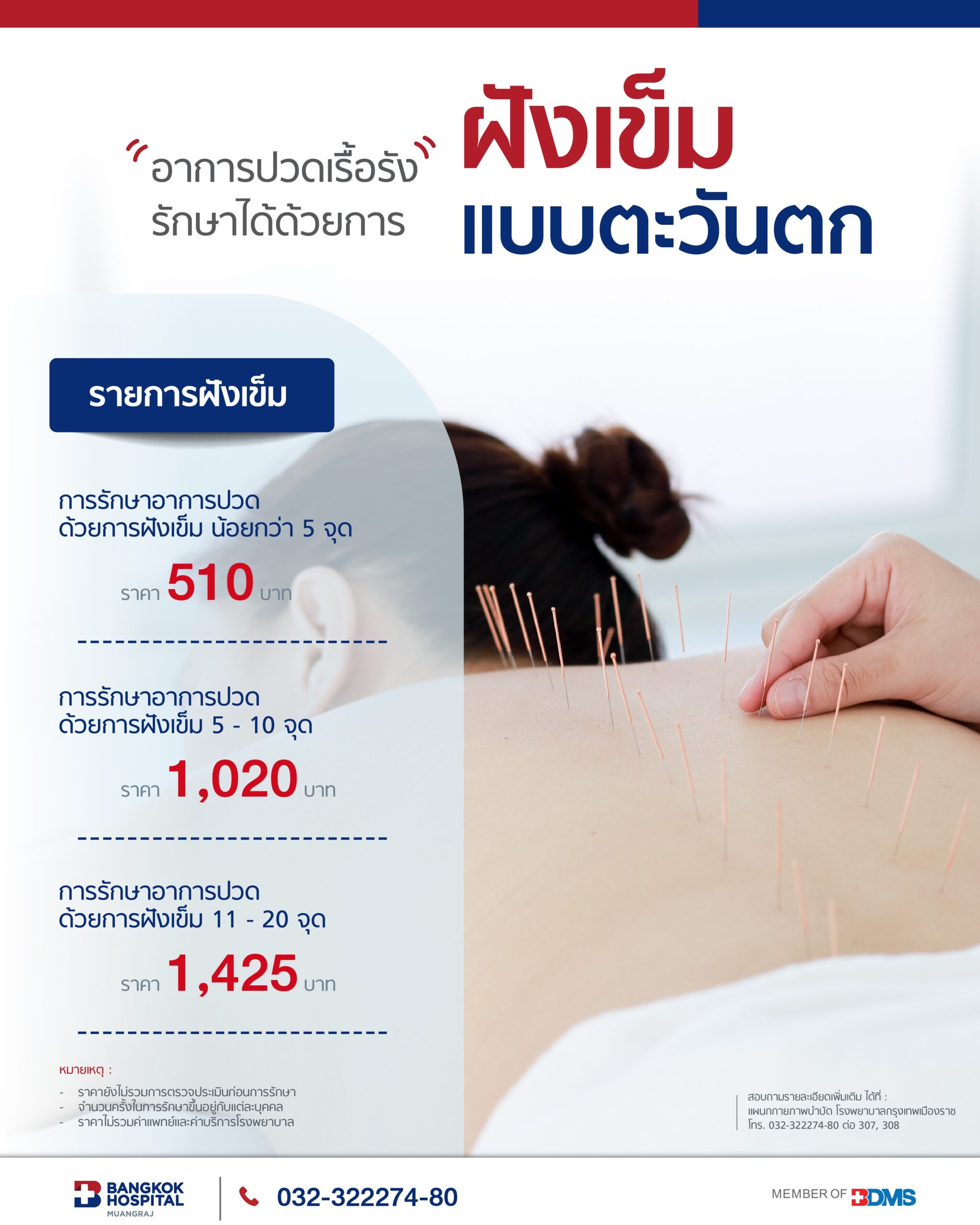 แพ็กเกจ ฝังเข็ม แบบตะวันตก