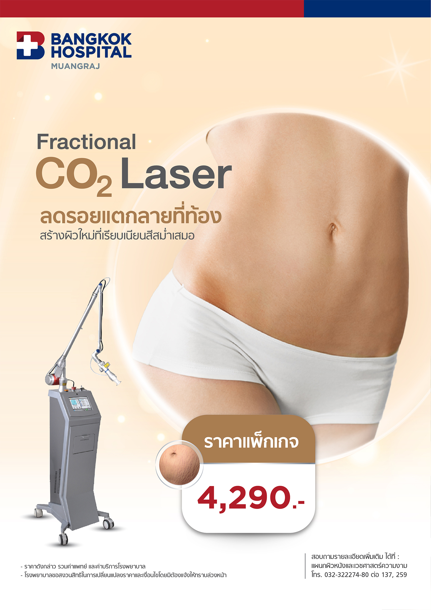 แพ็กเกจเลเซอร์รอยแตกลายที่ท้อง