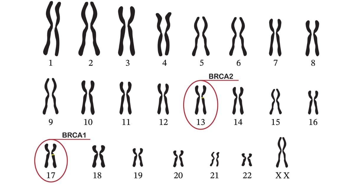 ตรวจยีน BRCA เช็กความเสี่ยงมะเร็งเต้านม