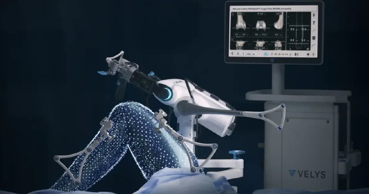 ជង្គង់​ហើម​ចំពោះ​មនុស្ស​ចាស់ ជា​សញ្ញា​ព្រមាន​នៃ​ជំងឺ​រលាក​សន្លាក់​ឆ្អឹង