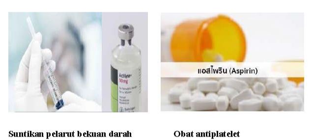 PI_CLT_Neuro-001_คำแนะนำผู้ป่วยโรคหลอดเลือดสมอง(Post stroke )(bahasa)_Page_07.jpg