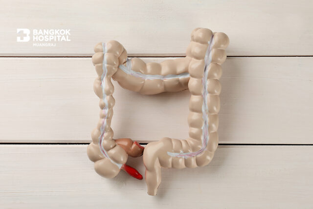 ไส้ติ่งอักเสบ สังเกตอย่างไร? Image