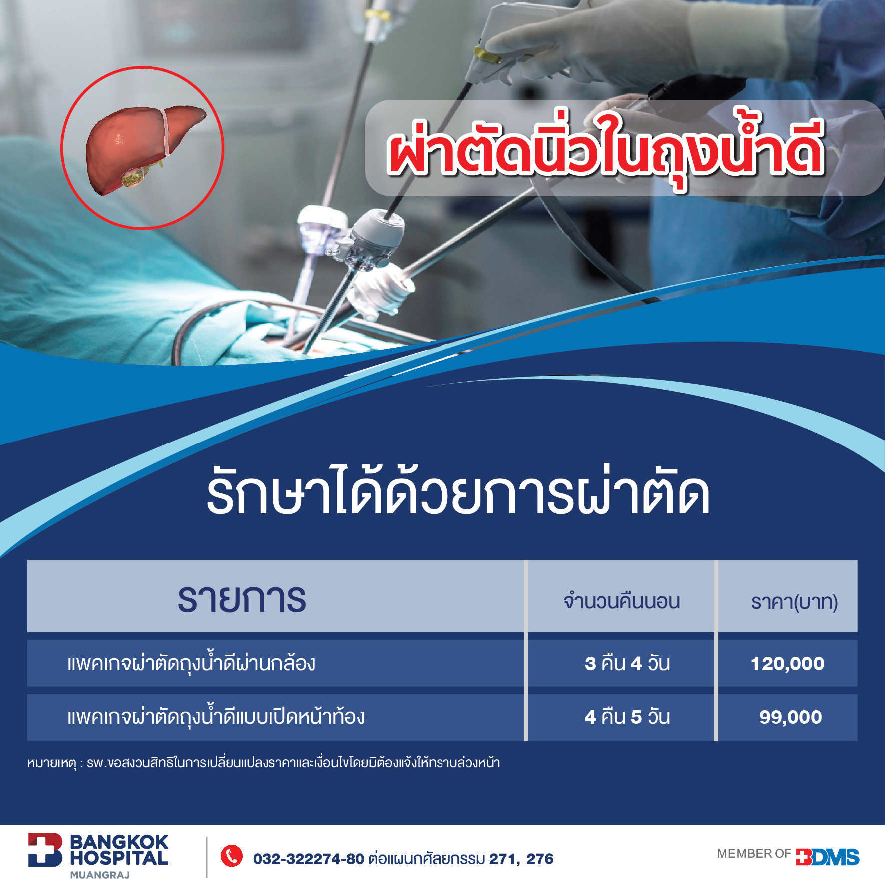 แพ็กเกจผ่าตัดนิ่วถุงน้ำดี