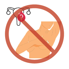 การตรวจคัดกรองมะเร็งเต้านม